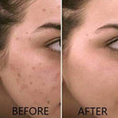 Rohto Mentholatum, Crème Hydratante Anti-Pigmentation Melano CC à la Vitamine C, 23 g