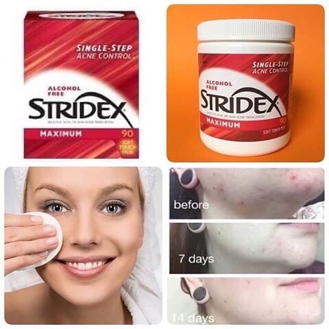 Stridex Daily Care Acne Pads with 2% Salicylic Acid, Maximum Strength 90pcs