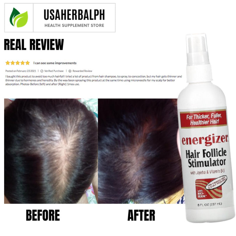 Hobe Labs, Energizer, Hair Follicle Stimulator, 237 ml